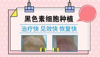 气血两虚的白癜风什么症状